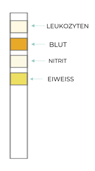 Test Result Negative