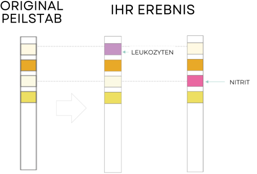 Test Results Positive Leukocytes or/and Nitrites