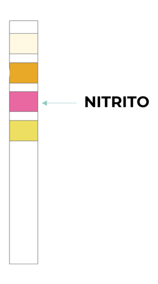 Test Result Positive Nitrite