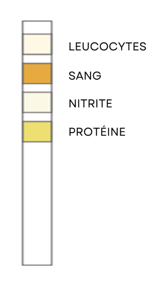 Test Result Negative