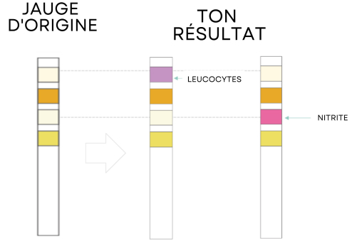 Test Results Positive Leukocytes or/and Nitrites