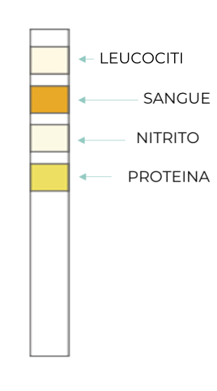 Test Result Negative