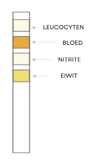 Test Result Negative