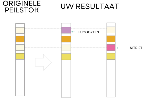 Test Results Positive Leukocytes or/and Nitrites